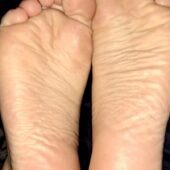 Foot fetis